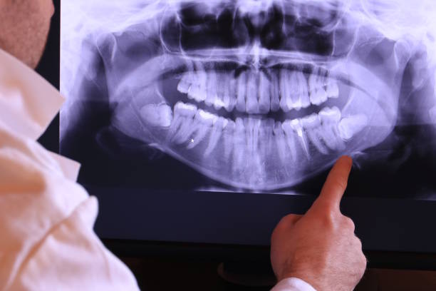 Best Emergency Root Canal Treatment in Potomac Heights, MD