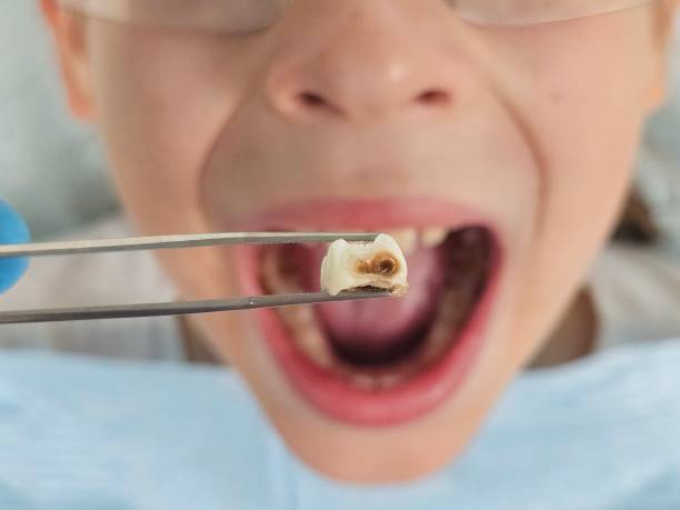 Best Weekend Emergency Dentist in Potomac Heights, MD
