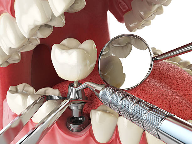 Best Emergency Cosmetic Dentistry in Potomac Heights, MD